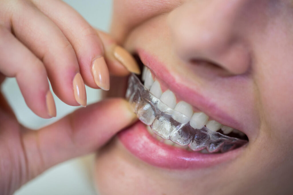 Ortodontia Aparelho Dental Juiz de Fora